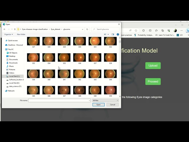 Eye Disease Prediction using Deep Learning | CNN Project