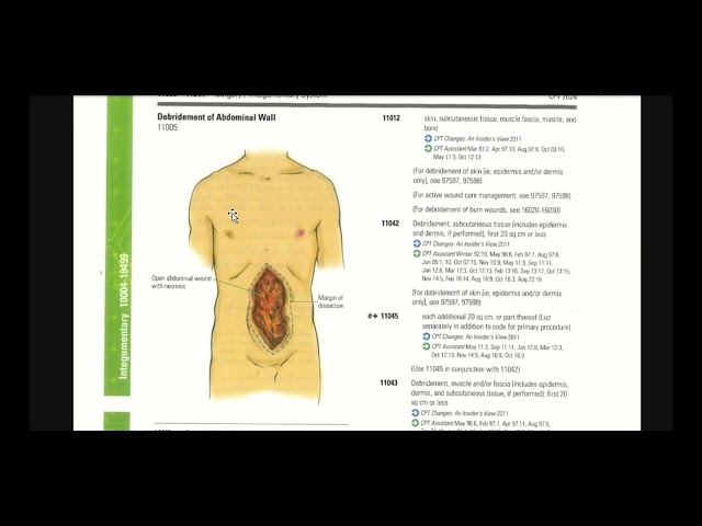 CPC Surgery (Integumentary 10004-19499 ) Chapter Part 1