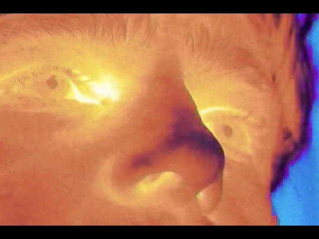 French The Kid - Therapy (Official Music Video)