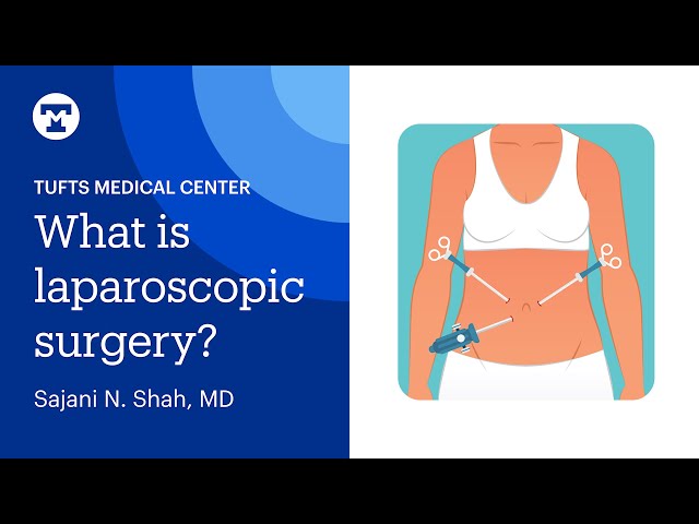 Laparoscopic Surgery Explained | Tufts Medicine