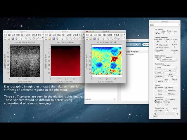 DSPView - Ultrasound and Image Processing in MATLAB