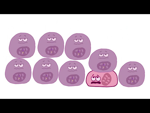 IDH Mutations in Cancer