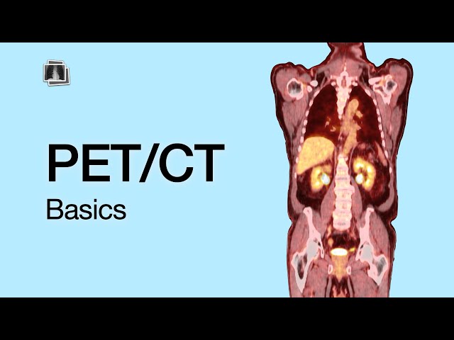 PET/CT Basics