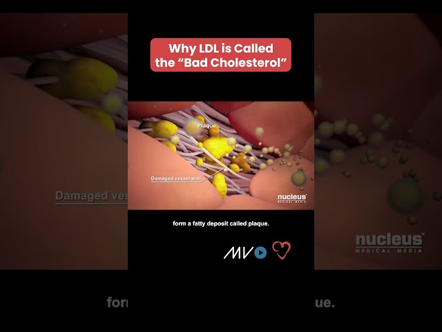 Why LDL is called the "bad" cholesterol