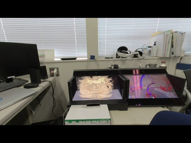 180 VR movie of DICOM 3D Viewer for SONY Spatial Reality Display ELF-SR1