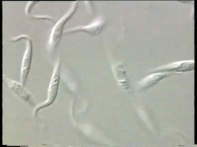 Trypanosoma