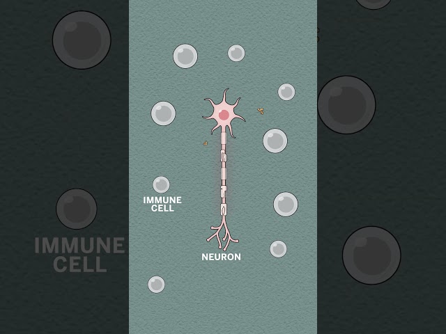 Treating autoimmune disease using your own cells