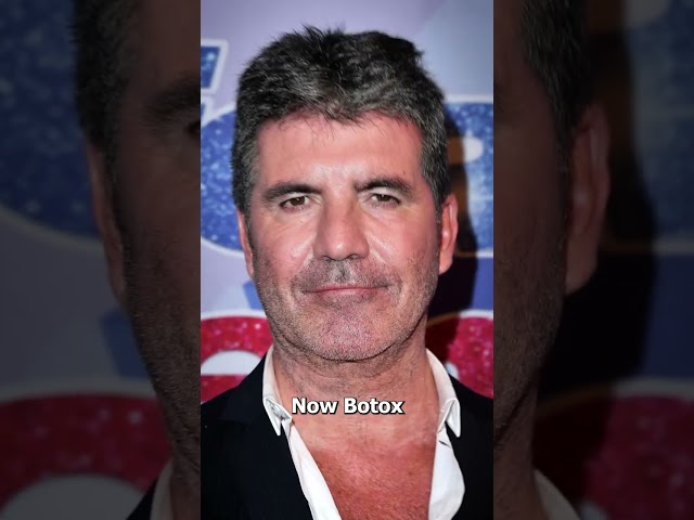 Cómo funciona realmente el Botox 💉🤔