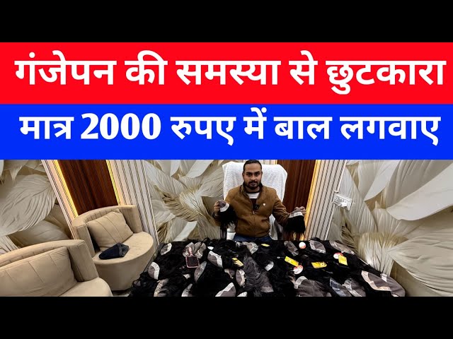 Hair Patch ₹2000 में । 1 पीस भी घर बैठे मंगाए | Hair Patch Wholesale Market Delhi | Hair Wig for Men