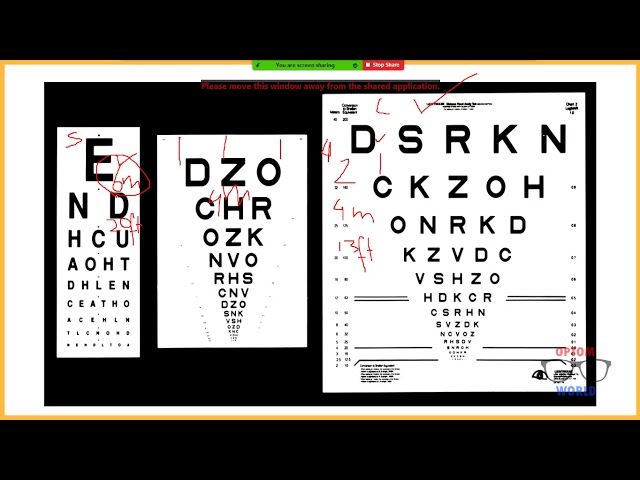 Visual Acuity Calculations in Low Vision in Urdu/Hindi