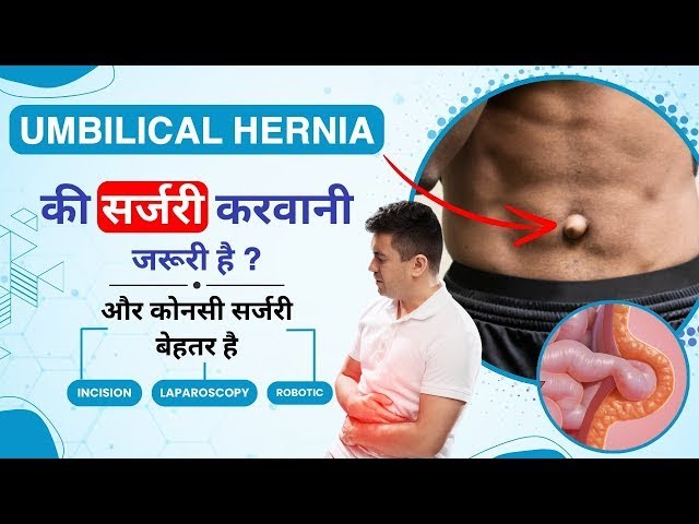What is Umbilical Hernia in Hindi | Umbilical Hernia - Causes, Recovery, Symptoms & Treatment