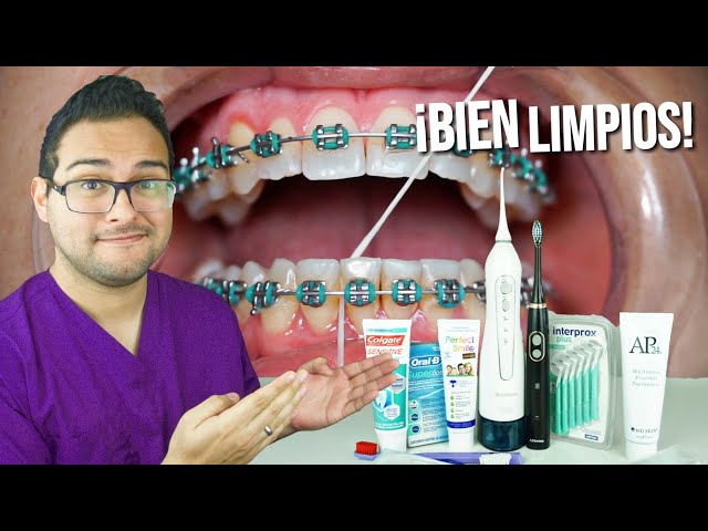 HOW TO BRUSH YOUR TEETH WITH BRACES! THE ULTIMATE GUIDE