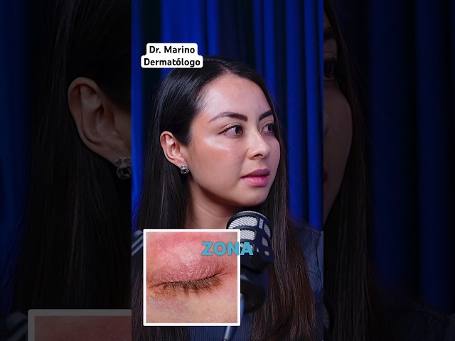 🍁Atopic dermatitis in adults✨ #dermatologist #dermatitis #skin #adult #eyes