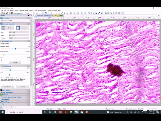 IMAGE ANALYSIS SOFTWARE
