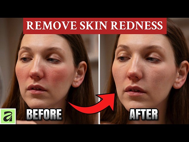 How to Remove Skin Redness in Affinity