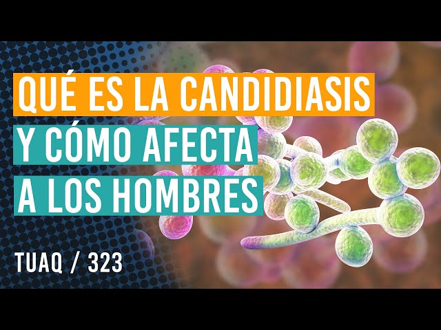 Qué es la #candidiasis y cómo afecta a los hombres