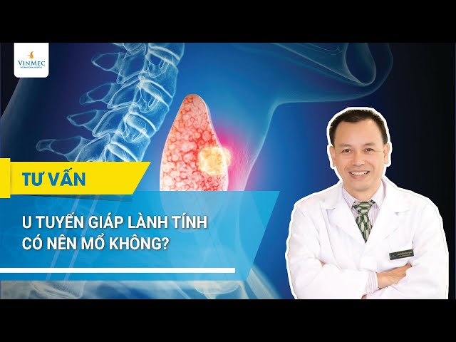 Should benign thyroid tumors be operated on? | Dr. Tran Huu Tuan, Vinmec Times City Hospital