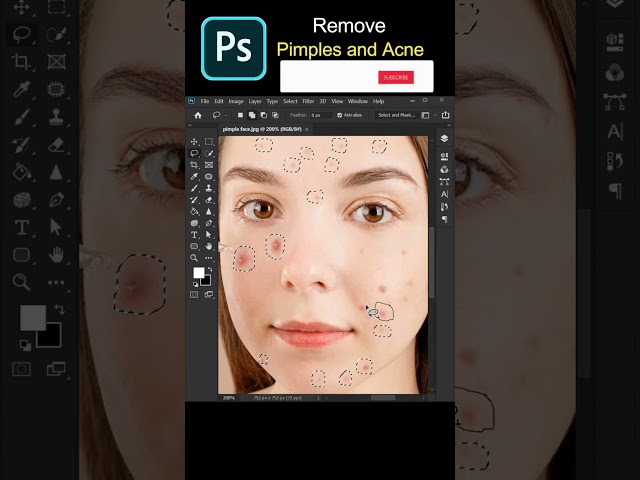 Remove Pimples and Acne | Photoshop Tutorials | #shorts