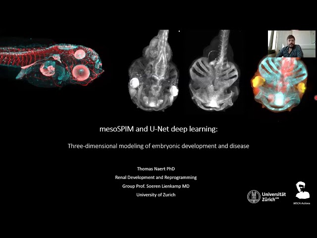 Thomas Naert: mesoSPIM and U-Net deep learning: three-dimensional modeling of embryonic development