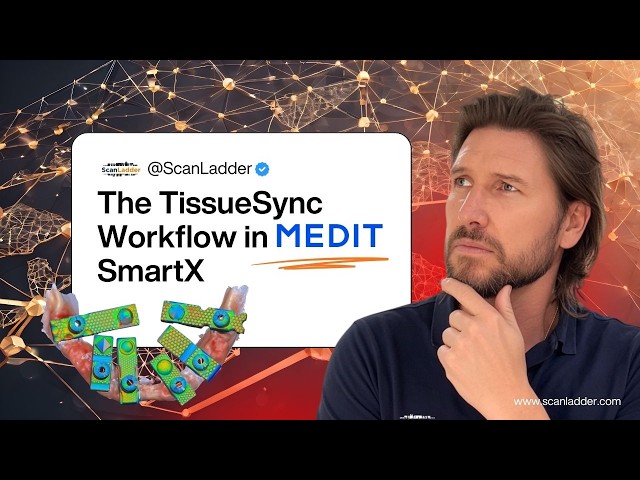 TissueSync in Medit SmartX: Full-Arch All-on-X Scanning Workflow Explained