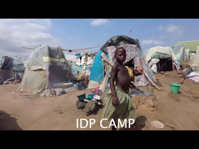 IDP Camp Conditions