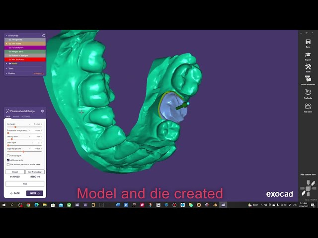 Using Exocad Model Creator to create a die for a single crown