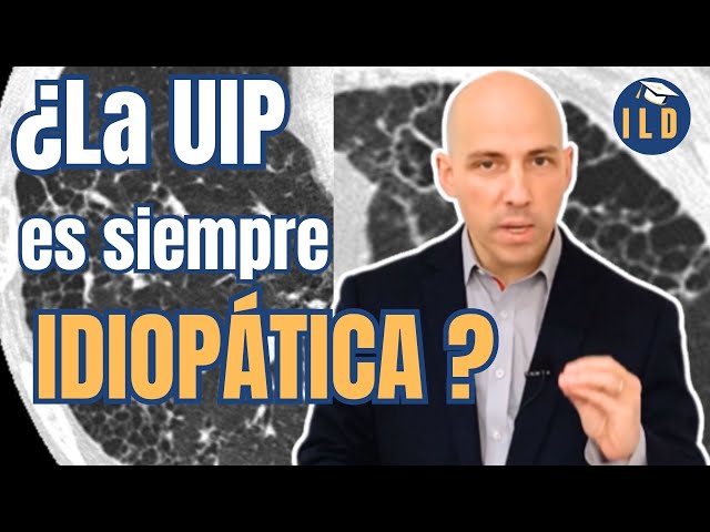 UIP: 6 Causas Identificadas por un Radiólogo Experto I Con Leandro Fassola 😎