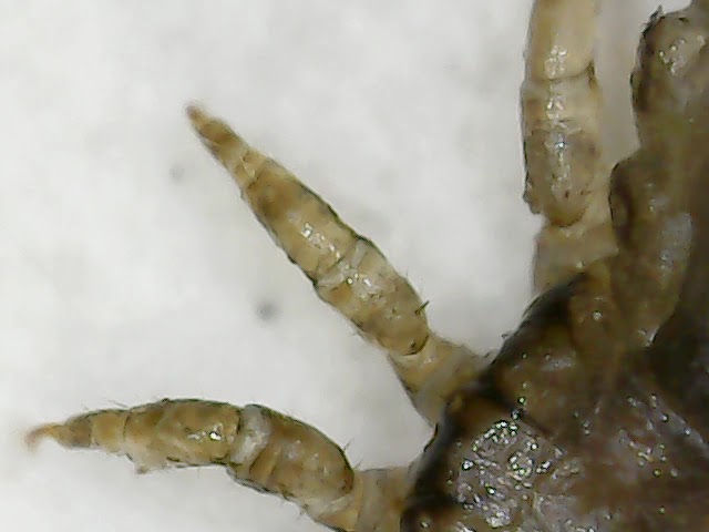 Head Lice Under Microscope 🔬 | Tiny Parasite Filmed From Different Eye (FDE)