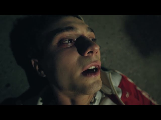 MOLLE - peor de lo que espere (Video Oficial)