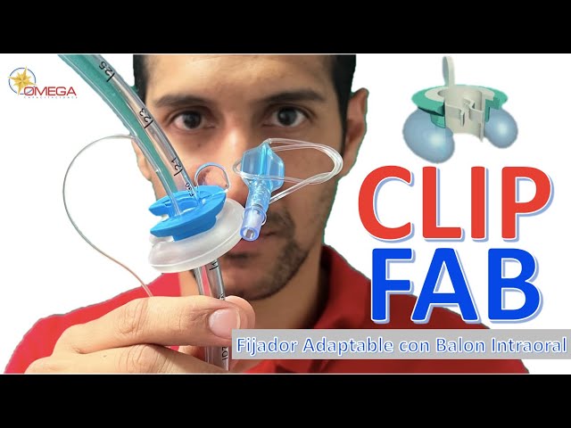 CLIP-FAB Fijador Adaptable con Balón Intraoral