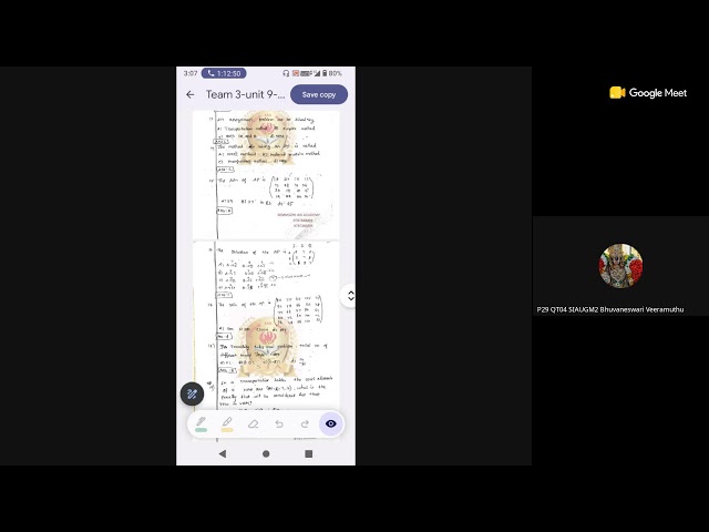 Transplantation problem Operation Research- UG TRB Maths 2