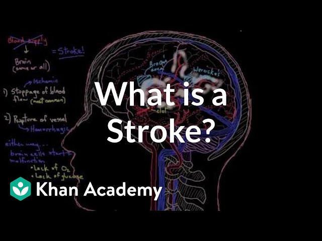 What is a stroke? | Circulatory System and Disease | NCLEX-RN | Khan Academy