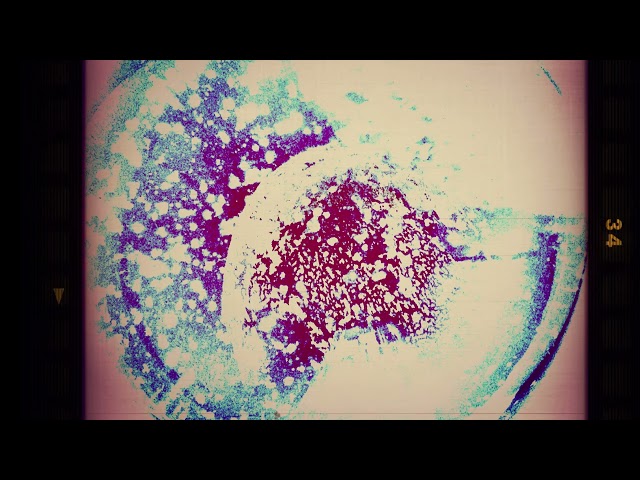 BODY & MIND PURIFICATION | SCALAR ENERGY FIELD