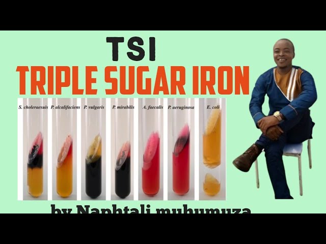 TSI | Triple Sugar Iron Agar | biochemical test -Microbiology