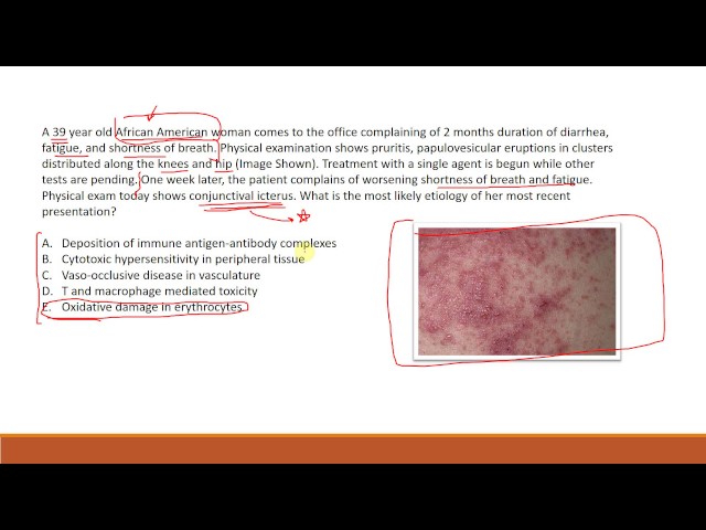 Test Taking Strategies - USMLE Step 2 CK