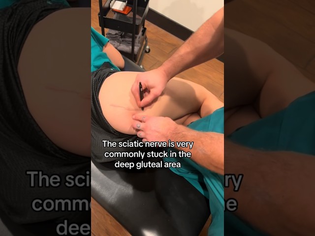 Sciatic Nerve Entrapment Dual Treatment for Chronic #sciatica Over 6 Months