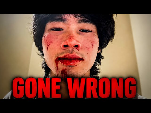 This TikToker Is Cutting Himself To Looks Max