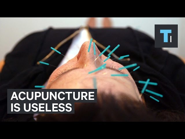 Acupuncture is useless