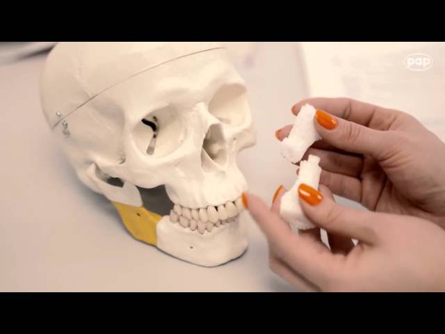 Bioimplant