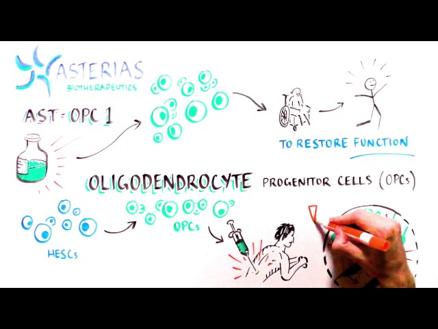 Progress and Promise of Stem Cell Research: Fixing nerve damage in spinal cord injury