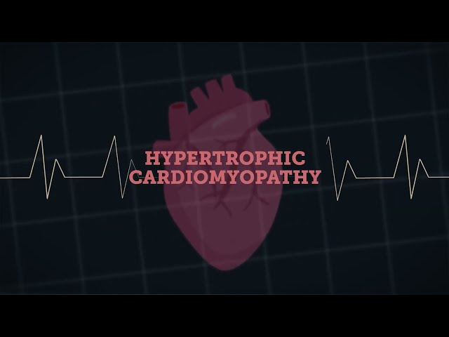 What is HCM?