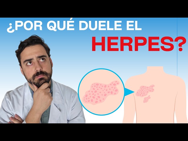 Why does herpes hurt so much?