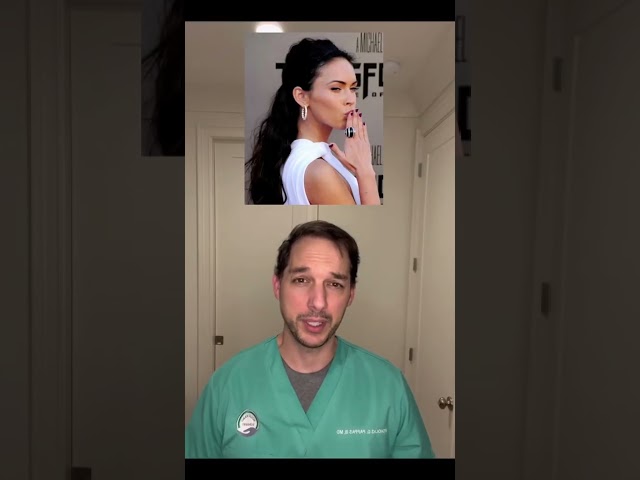 Hand surgeon discusses toe thumbs #MilesTeller #MeganFox #Toethumb #Brachydactyly #Doctor #Thumb