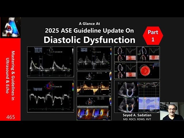 2025 ASE Guideline Update On Diastolic Dysfunction-Part 1