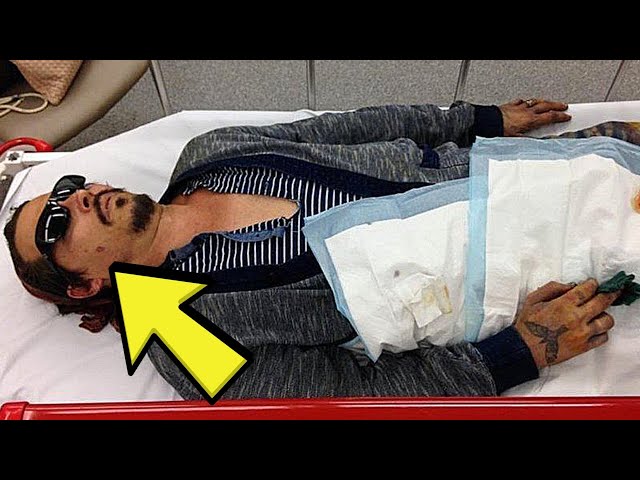 Johnny Depp on How Amber Heard Cut his Finger Off | Trigger Warning