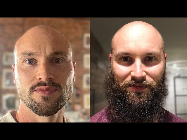 Bald Men Look Most Attractive With A Big Beard?