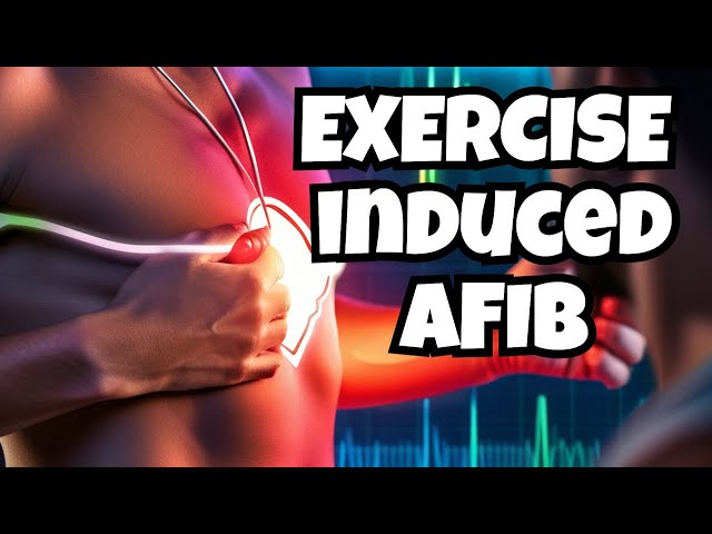 Exercise Induced AFib: Expert Tips