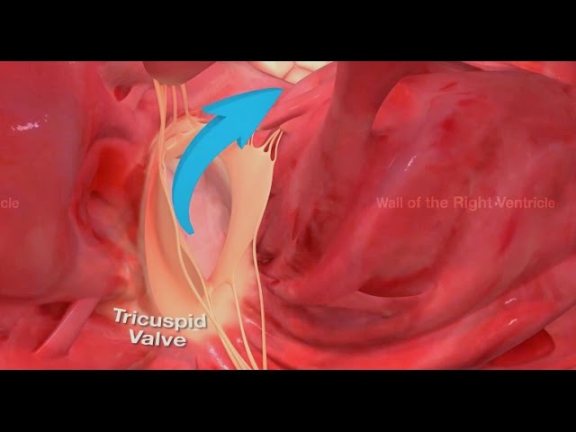 360 video - Tricuspid Valve - Right Ventricle - medmovie.com