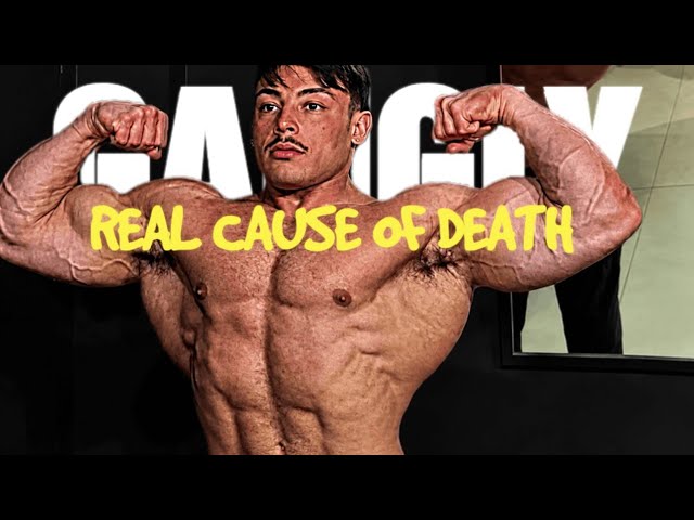 Gabriel Ganley Cause Of Death Revealed