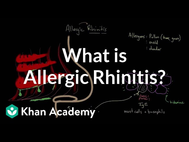 What is allergic rhinitis? | Respiratory system diseases | NCLEX-RN | Khan Academy